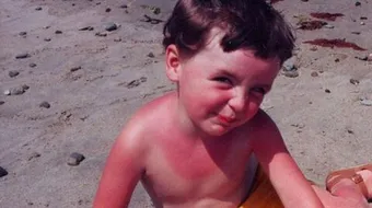 كيف أعالج وجهي من حروق الشمس