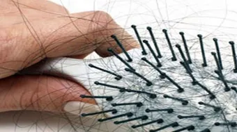 كيف أعالج شعري من التساقط