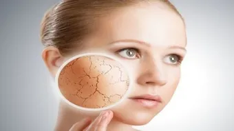 كيف أعالج بشرتي من الجفاف