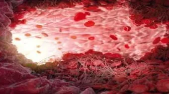 كيف يحدث تجلط الدم