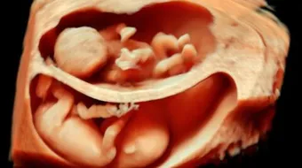 كيف تعرف الأم أنها حامل بتوأم