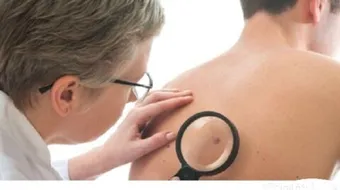 كيف يبدأ مرض السرطان