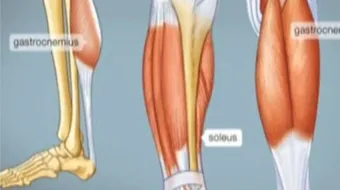 كيف يحدث الشد العضلي
