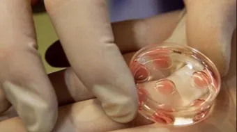 كيف تتم عملية أطفال الأنابيب - فيديو