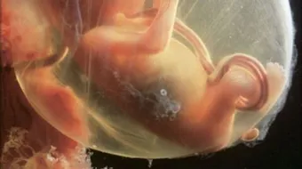 كيف تكون حركة الجنين في الشهر الثالث