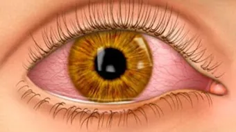 كيف تتم عملية الرؤية عند الإنسان