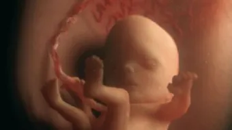 كيف يكون شكل الجنين في الشهر الرابع