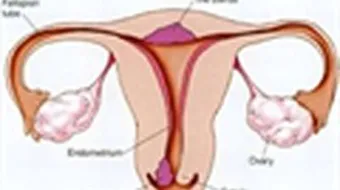 كيف يتم اكتشاف سرطان الرحم