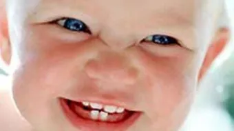 كم عدد الأسنان اللبنية عند الأطفال
