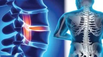 كم فقرات العمود الفقري