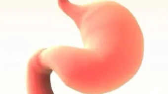 كيف أصغر حجم معدتي