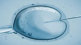 كيف تكون عملية طفل الانابيب