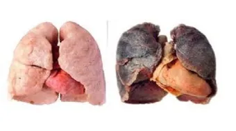 كيف يتم تنظيف الرئة من آثار التدخين