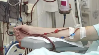 كيفية غسيل الكلى