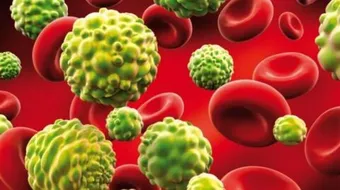 كيف تكتشف مرض السرطان