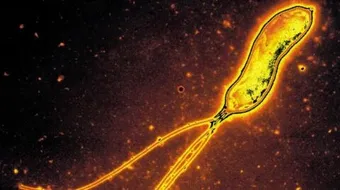 كيفية القضاء على جرثومة المعدة