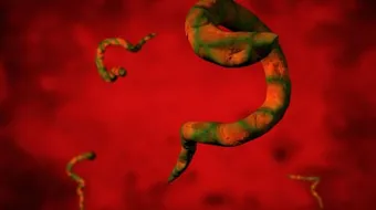 كيف تتخلص من ديدان البطن