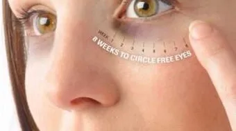 طريقة التخلص من السواد تحت العين