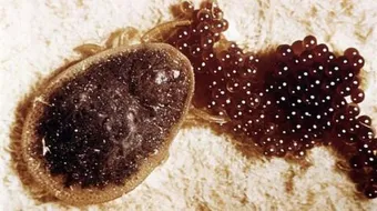 كيف تتخلص من حشرة البق