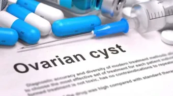 كيفية التخلص من التكيس على المبايض