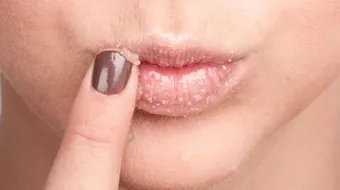 طريقة التخلص من سواد الشفاه