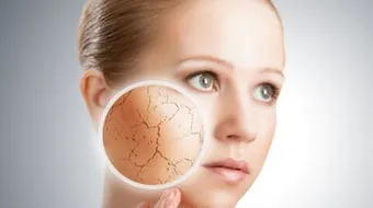 كيف تتخلص من جفاف الوجه