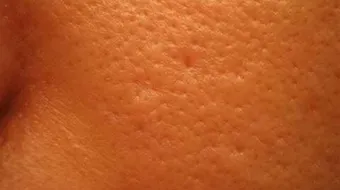 كيف تتخلص من مسامات الوجه