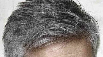 طريقة التخلص من الشيب طبيعياً