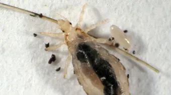 كيفية التخلص من بيض القمل