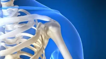 كيف تتخلص من هشاشة العظام