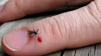 طريقة التخلص من قرصة الناموس