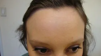 كيفية إنبات شعر مقدمة الرأس