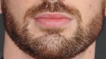 كيف أزيد من كثافة شعر الذقن