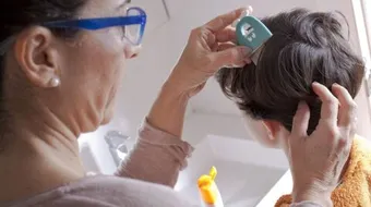 كيف أبعد القمل