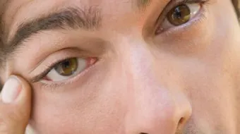 كيف أبعد السواد الي تحت العين