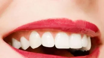 كيف تحافظ على أسنانك