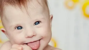 كيفية معرفة الطفل المنغولي