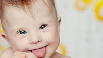 كيف تعرف الطفل المنغولي حديث الولادة