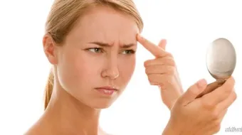 كيفية إزالة حب الشباب