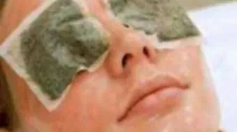 طريقة لإزالة السواد تحت العينين