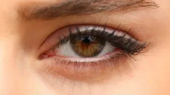 كيفية إزالة الهالات السوداء تحت العين