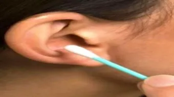 طريقة إزالة شمع الأذن