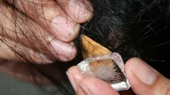 كيفية إزالة العلكة من الشعر