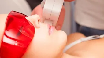 كيفية إزالة الشعر بالليزر