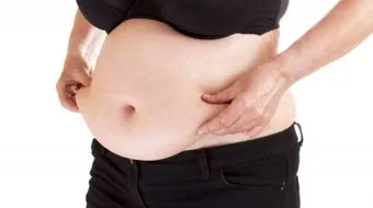 كيفية إزالة الكرش