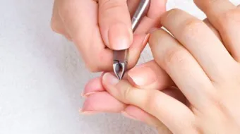 كيفية إزالة الزوائد الجلدية