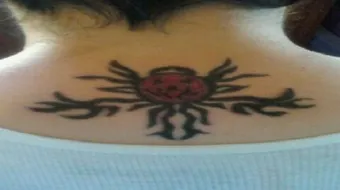 كيفية إزالة الوشم بالأعشاب