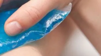 كيف أزيل آثار الكدمات