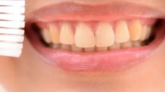 كيفية إزالة صفار الاسنان