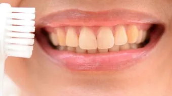 كيفية إزالة صفار الأسنان